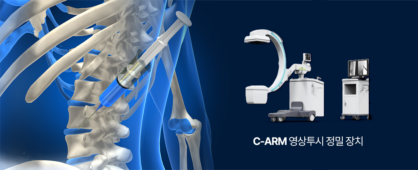 C-ARM 영상투시 정밀 장치