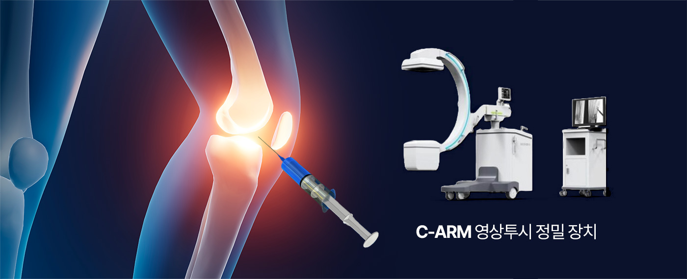 C-ARM 영상투시 정밀 장치